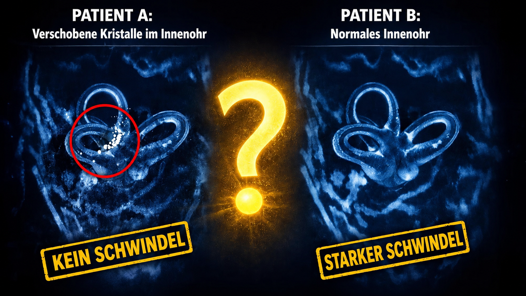 Patient A und Patient B: Innenohr-Befund im Vergleich